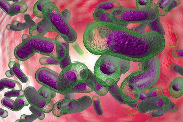 SBAD 2022: Controvérsias do supercrescimento bacteriano do intestino delgado