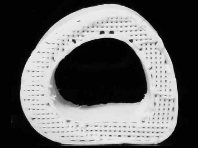 Cientistas consertam fraturas com ossos impressos em 3D