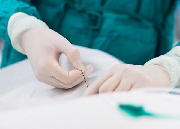 Abscesso hepático: como fechar o diagnóstico e conduzir o tratamento