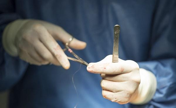 cirurgia cardiaca