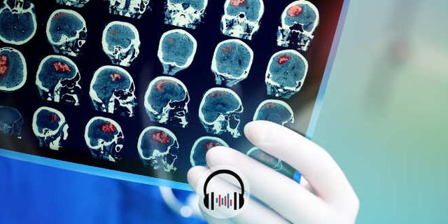 Como reconhecer e monitorizar a hipertensão intracraniana? [podcast]