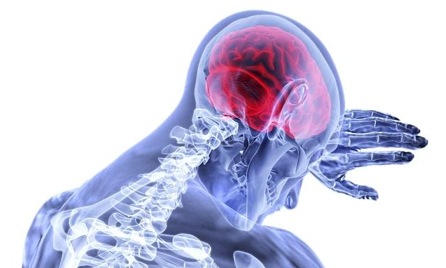 Covid-19 e neurologia: AVC de grandes vasos como apresentação de Covid-19 em jovens