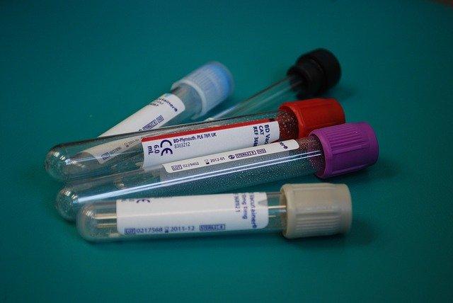Tubos utilizados para coleta de sangue com fim de testagem para valores de amônia.