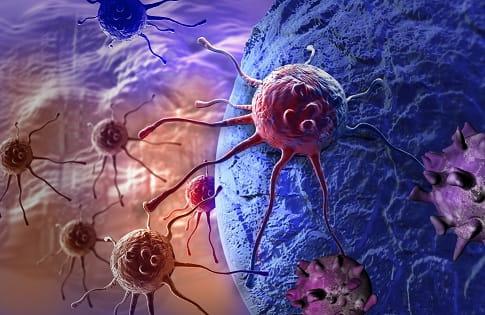 Representação gráfica de tumores estromais gastrointestinais (GIST).