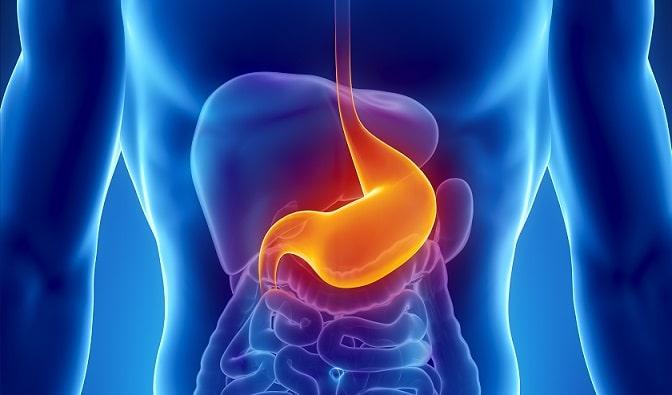 imagem digital de corpo humano mostrando onde acontece a doença do refluxo gastroesofágico