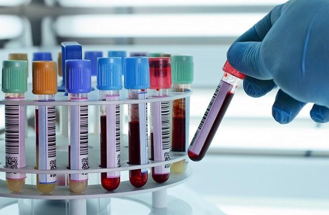 O que todo clínico precisa saber sobre alterações hepáticas e hipertireoidismo?