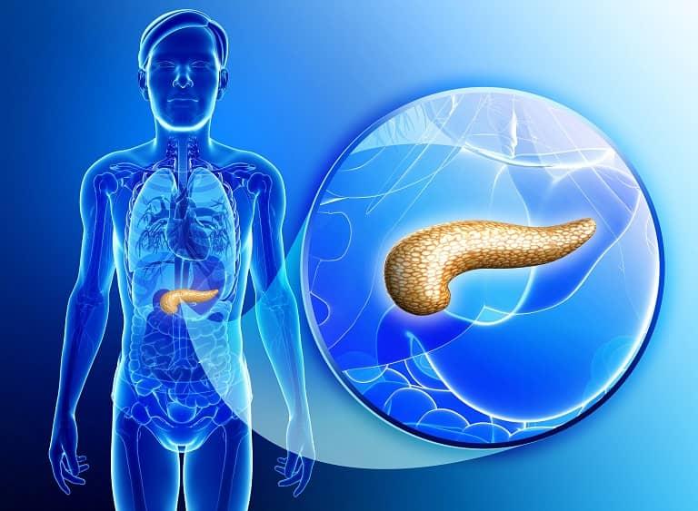 O que há de novo no tratamento da pancreatite aguda?
