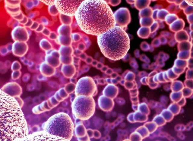 Exsudato amigdaliano = faringite bacteriana. Verdade ou mito?