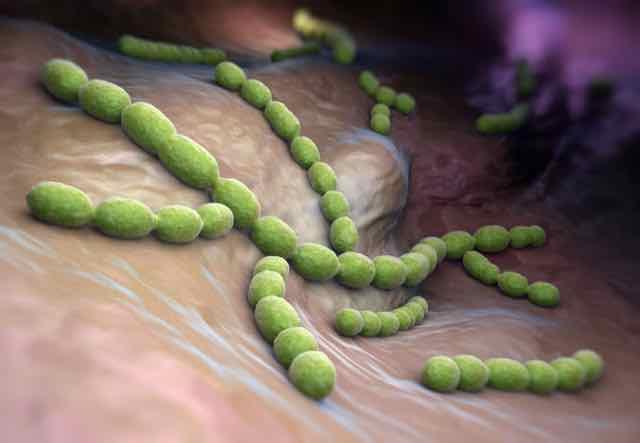 Será o fim dos protocolos de Sepse na medicina de emergência?