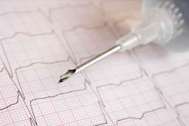ecg e uma agulha