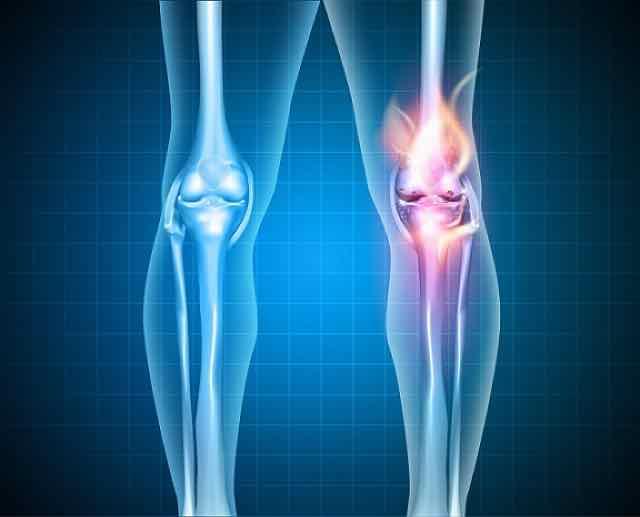 Nova ferramenta ajuda médico na gestão da síndrome do túnel do carpo e osteoartrite de joelhos