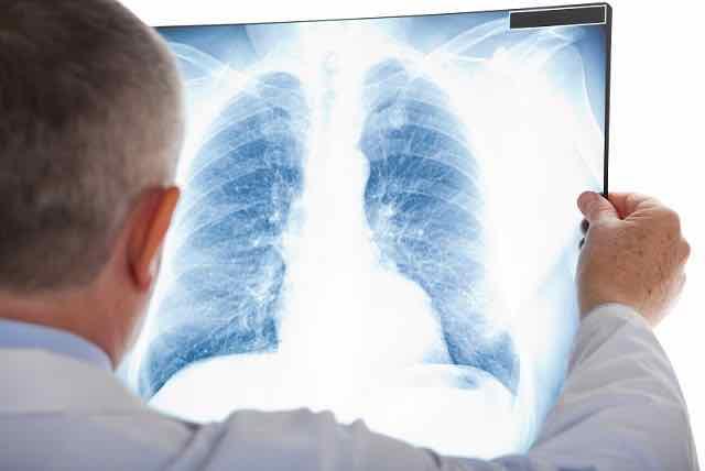Tratamento pós-desmame da pneumonia complicada: devemos usar antibióticos intravenosos ou orais?