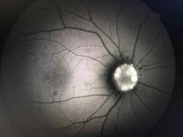 Você sabe qual exame realizado, alteração e diagnóstico da imagem?