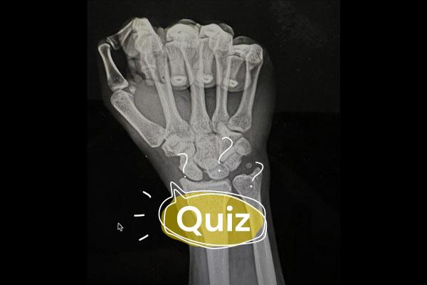 quiz_18_07_selo -