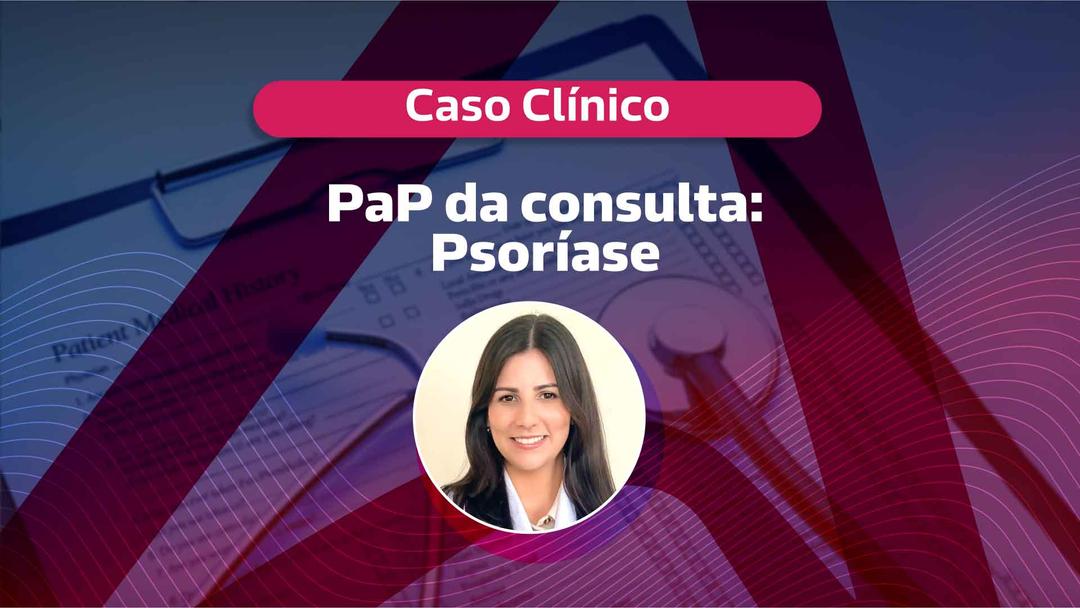 Caso Clínico: Psoríase