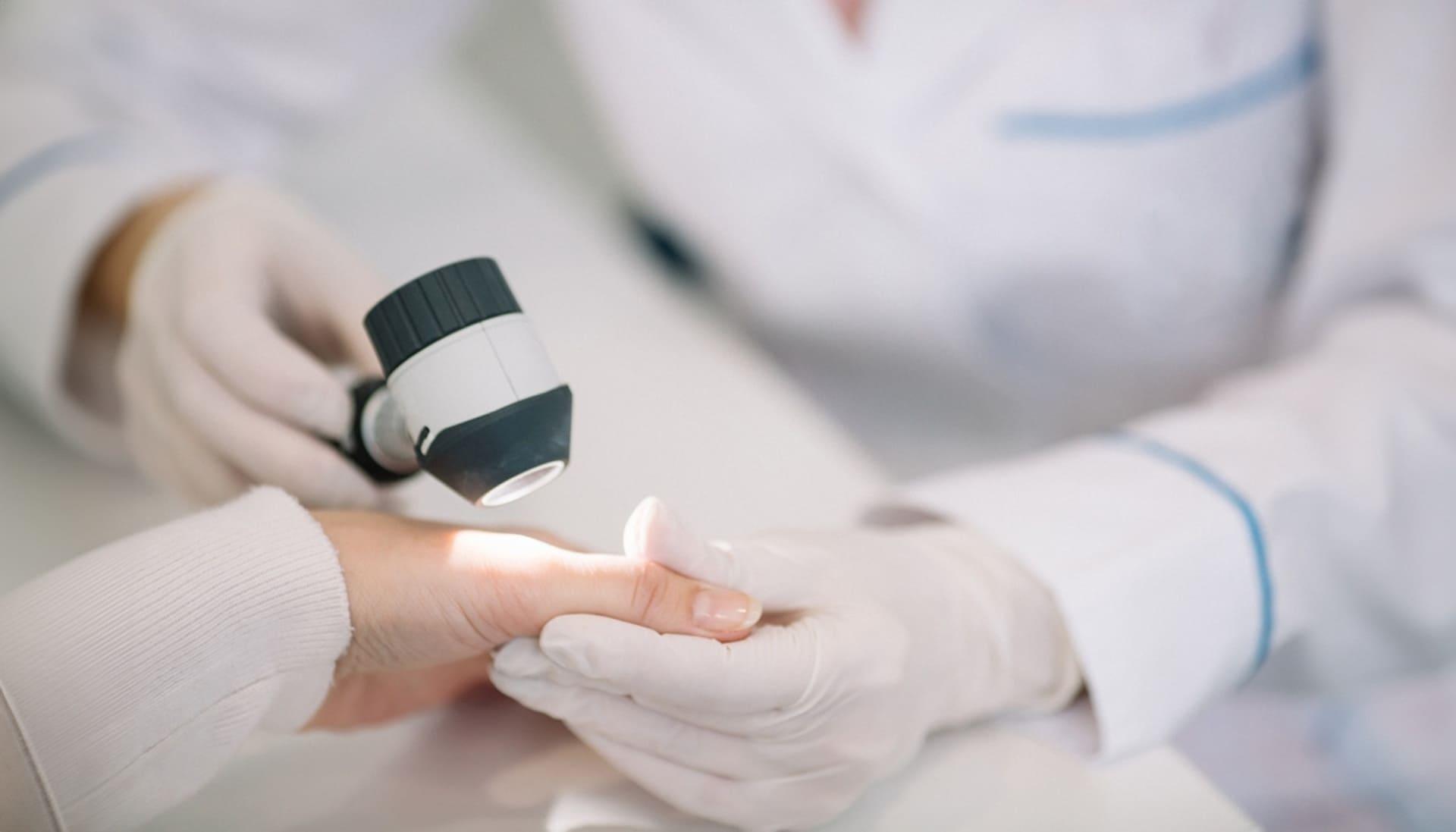 Dermatologista analisando manchas em unhas de paciente. -