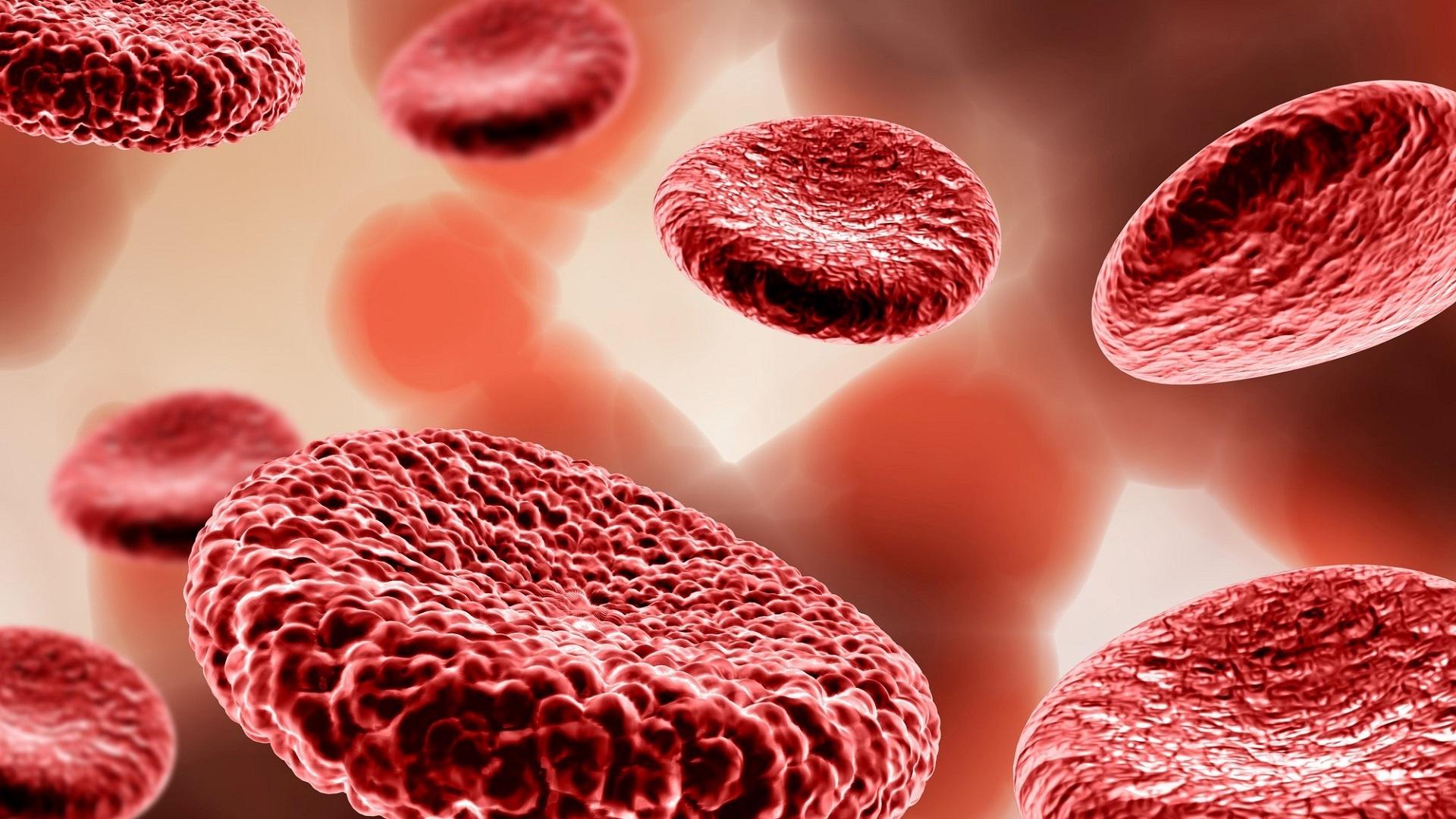 Estudo Apollo para leucemia promielocítica de alto risco: Dados do EHA 2024 