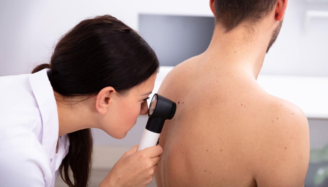 dermatologista fazendo dermatoscopia