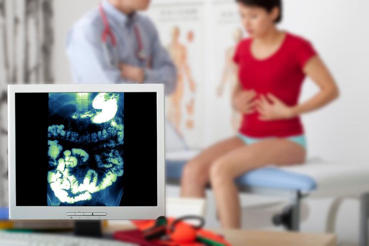 Eficácia do transplante de microbiota fecal no tratamento da síndrome do intestino irritável