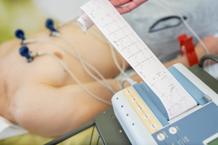 ECG: como diferenciar o supra do infarto do supra da pericardite?