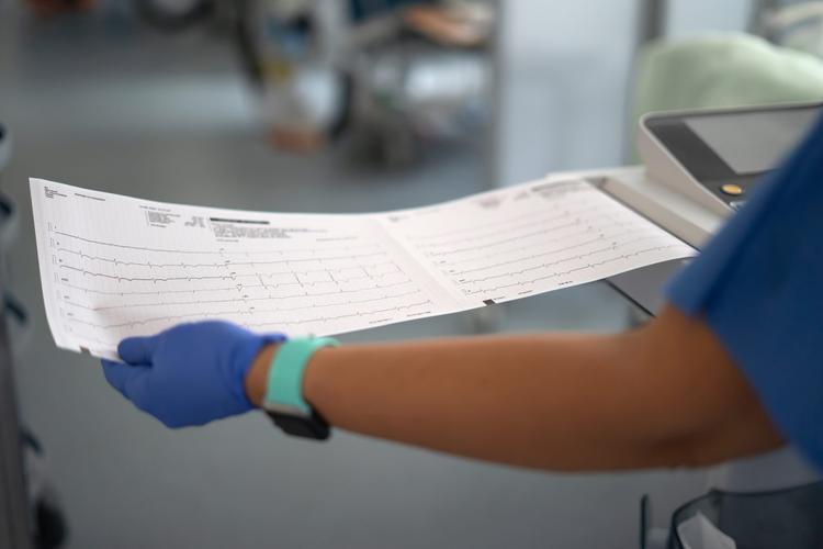 Causas não-IAM para a elevação de ST no eletrocardiograma