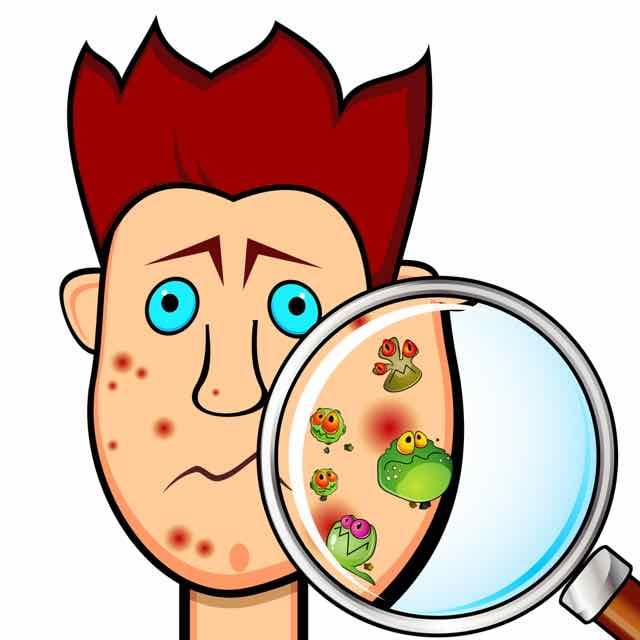 7 Mitos sobre a Acne passados a limpo