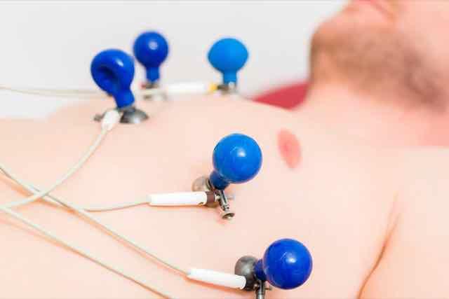 Fibrilação atrial: manejo diagnóstico e terapêutico