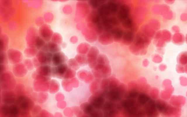 Suplementação de ferro em pacientes críticos com anemia é eficaz?