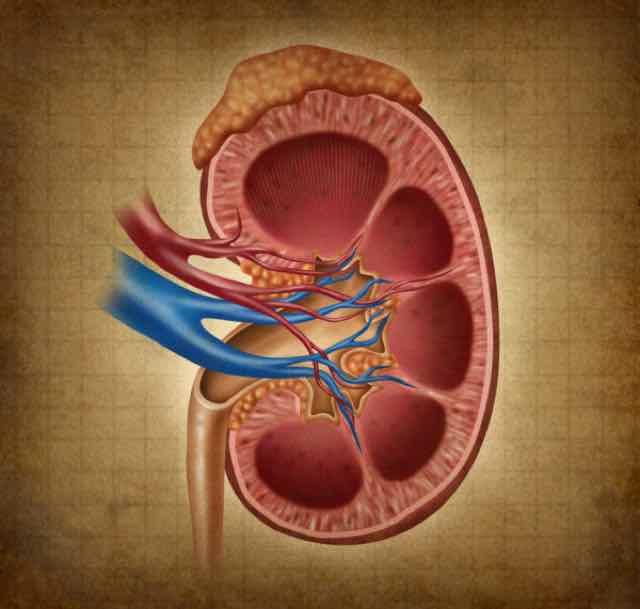 glomerulonefrite