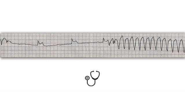 Caso clínico: qual a causa da piora súbita do paciente?