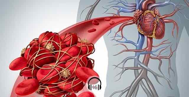 paciente com embolia pulmonar