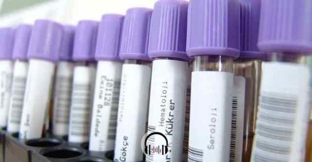 rotulos de exames de sangue