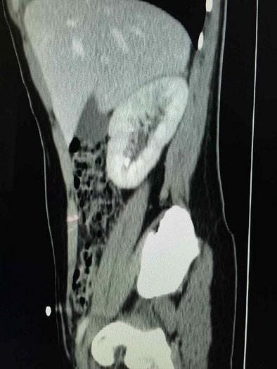 atlas de radiologia
