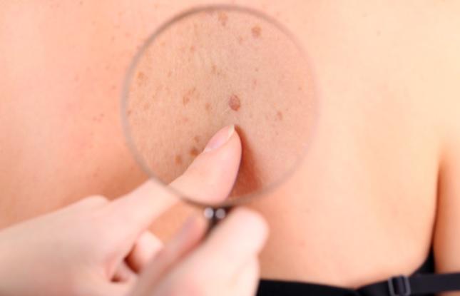 doenças dermatológicas