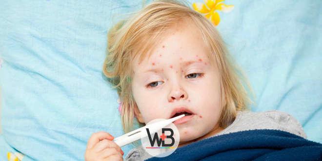 Whitebook: saiba mais sobre o sarampo