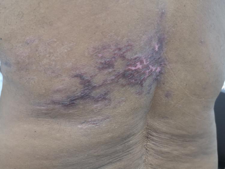 Caso Clínico: idoso com dor intensa em abdome e dorso há 4 meses