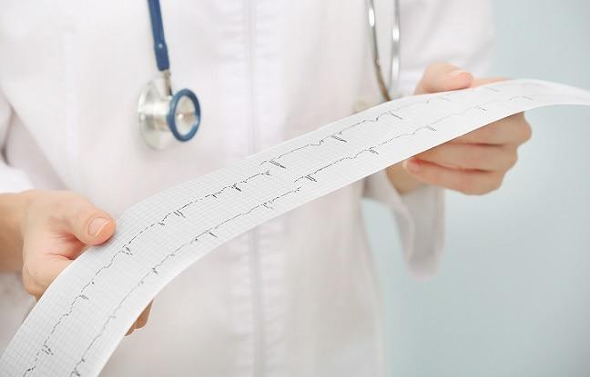 médico segurando resultado de eletrocardiograma com taquicardia supraventricular