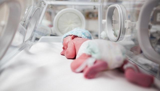 recém-nascido em uti neonatal para inserção de cateter central