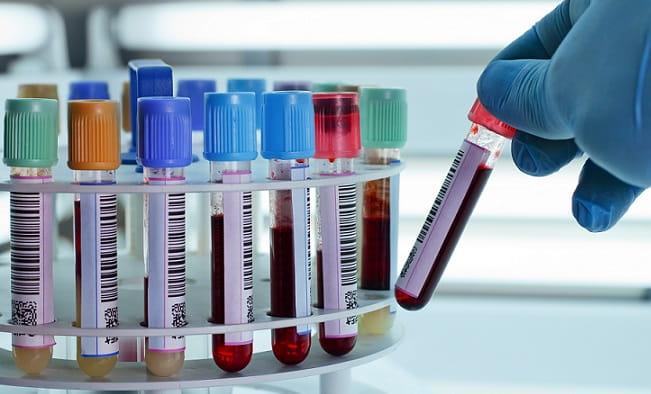 Tudo o que o médico precisa saber sobre o hemograma: série vermelha