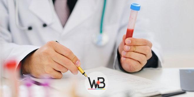 médico segurando amostra de sangue para exame laboratorial de síndrome do desconforto respiratório agudo