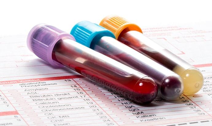 tubos de sangue para exame diagnóstico de Covid-19