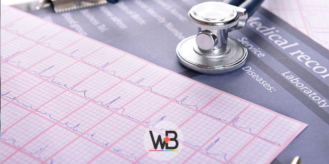 eletrocardiograma de paciente com covid-19