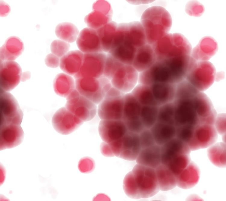 Pesquisadores analisam como a Covid-19 afeta pacientes imunossuprimidos como aqueles com doenças hematológicas