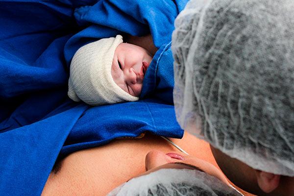 hipertensão pós-parto