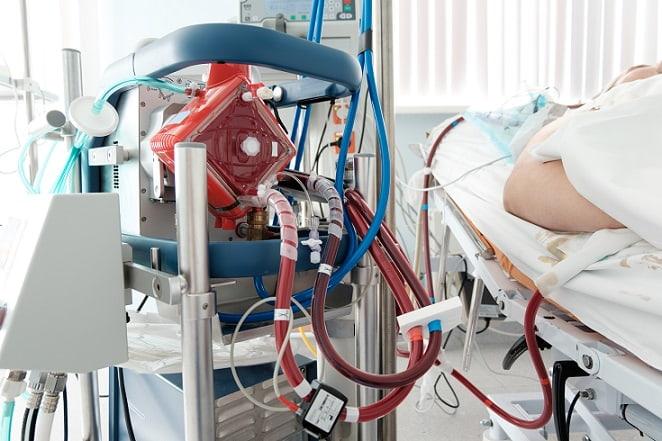 utilização do ECMO em pacientes com Covid-19