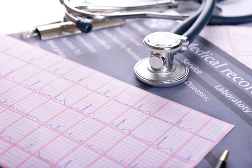 Oclusão do apêndice atrial esquerdo reduz ocorrência de AVC?