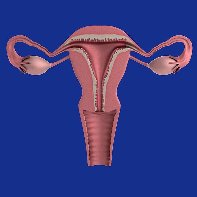 Transplante de útero e suas complexidades