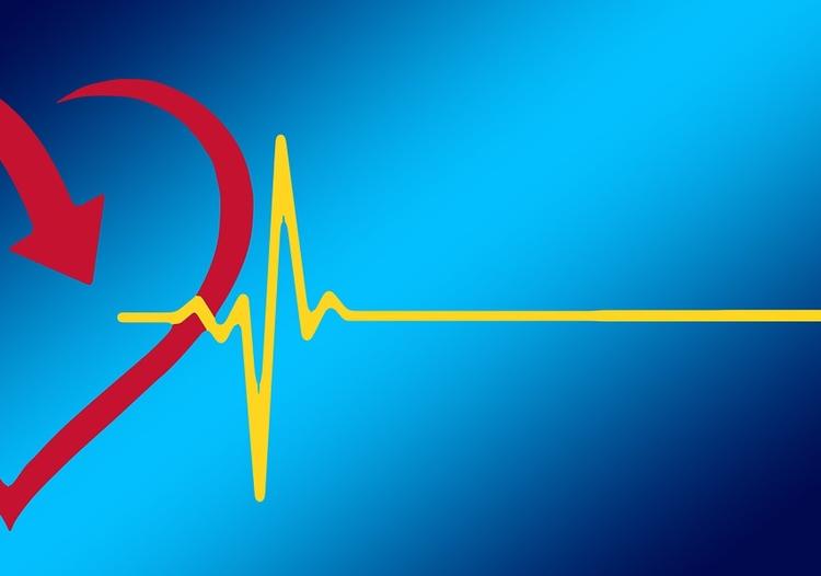 Complicações mecânicas do infarto