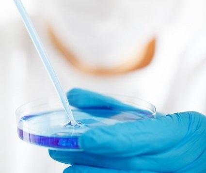 Aspergilose pulmonar associada a Covid-19