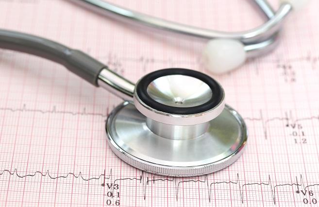 técnica lariat para fibrilação atrial